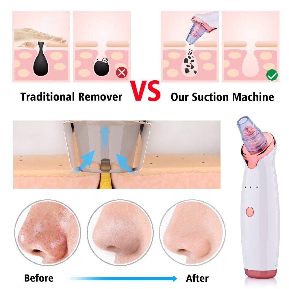 Blackhead Remover Vacuum Pore Cleaner Electric Nose Face Deep Cleansing Skin Care Machine Birthday Gift Dropshipping Beauty Tool