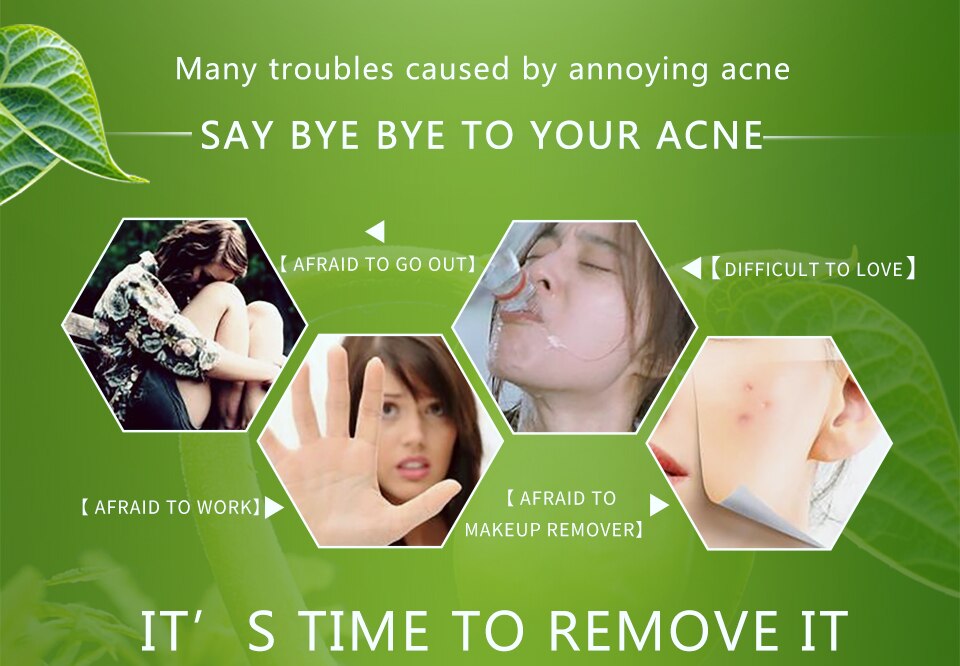 HEMEIEL Acne Treatment Face Cream Anti Acne Scar Removal Pimple Blackhead Moisturizing Whiten Oil-control Shrink Pores Skin Care