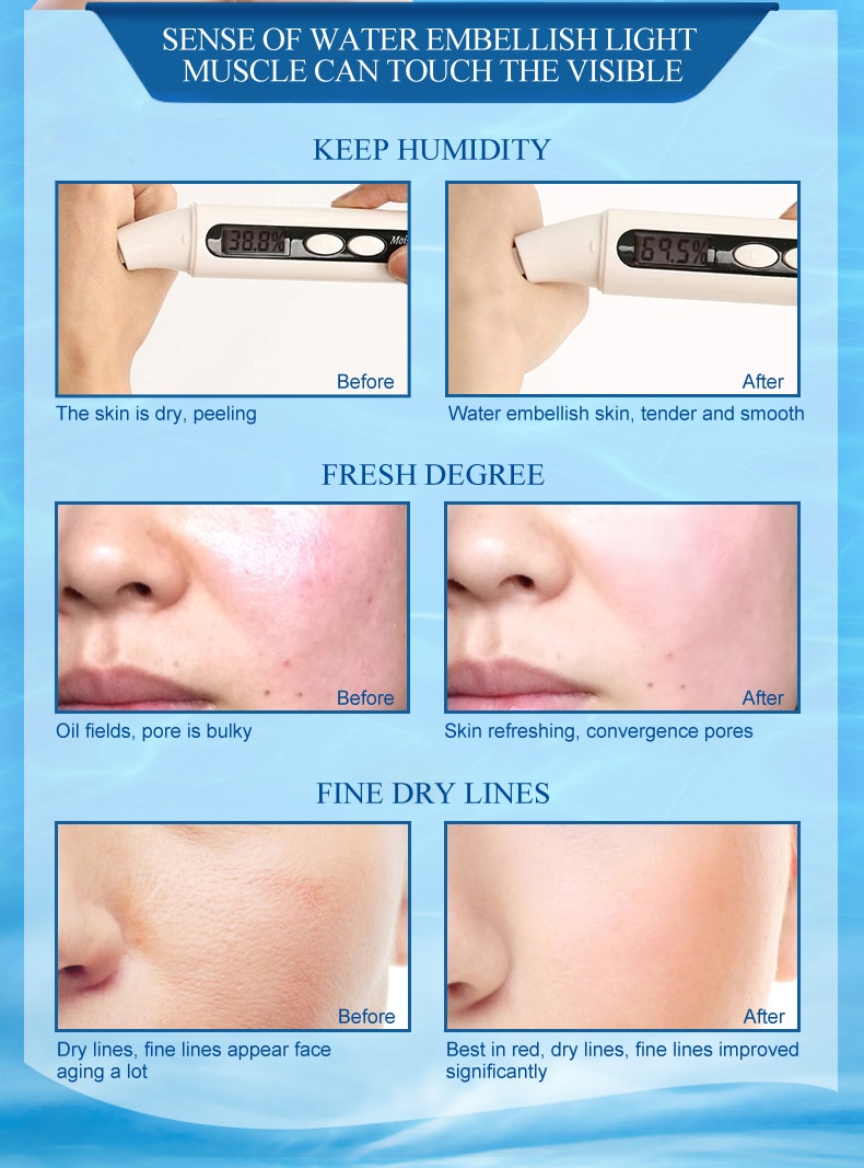 Moisture Cream  Skin Care Face Lift Essence Tender Anti-Aging Whitening Wrinkle Removal Face Cream Hyaluronic Acid