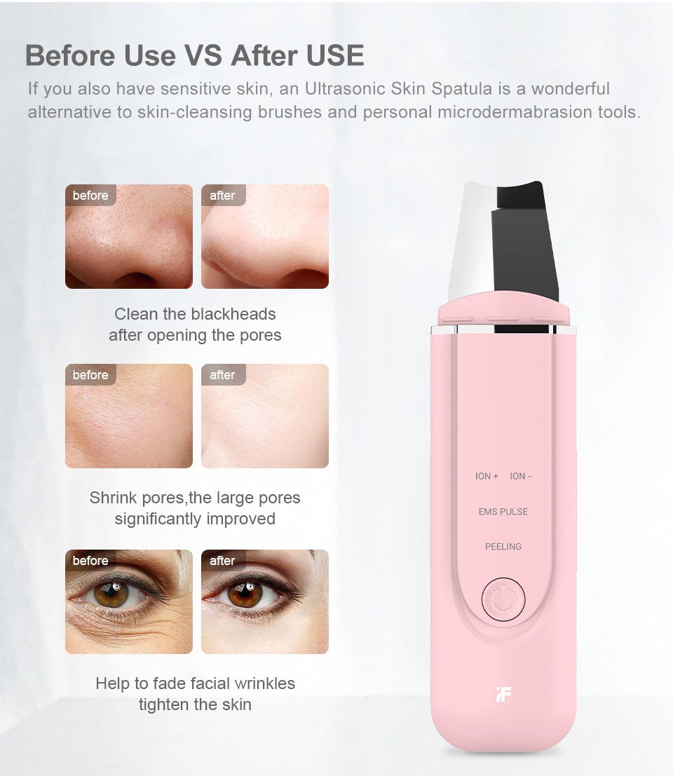 InFace Ultrasonic Facial Skin Scrubber Cleaner Ion Acne Blackhead Remover Peeling Shovel Cleaner Facial Massager Skin Care