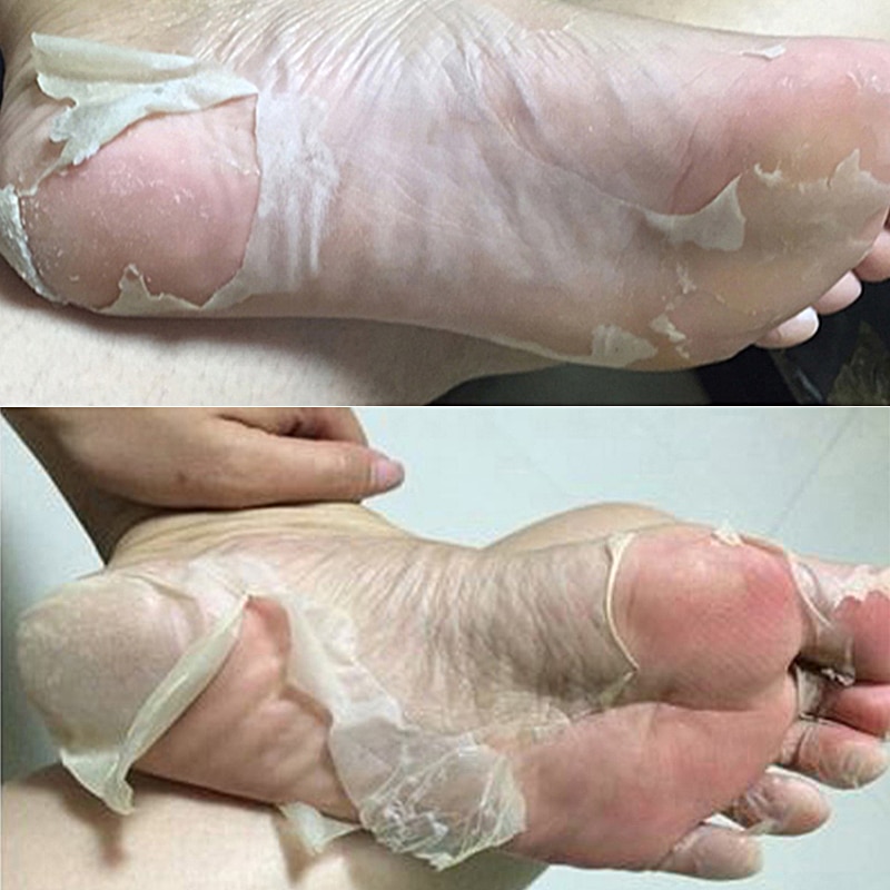 3pair=6 piece Exfoliating Foot Mask Foot Patch Magic Skin Peeling Dead Skin Feet Mask Socks Sosu Socks for Pedicure Socks Cream