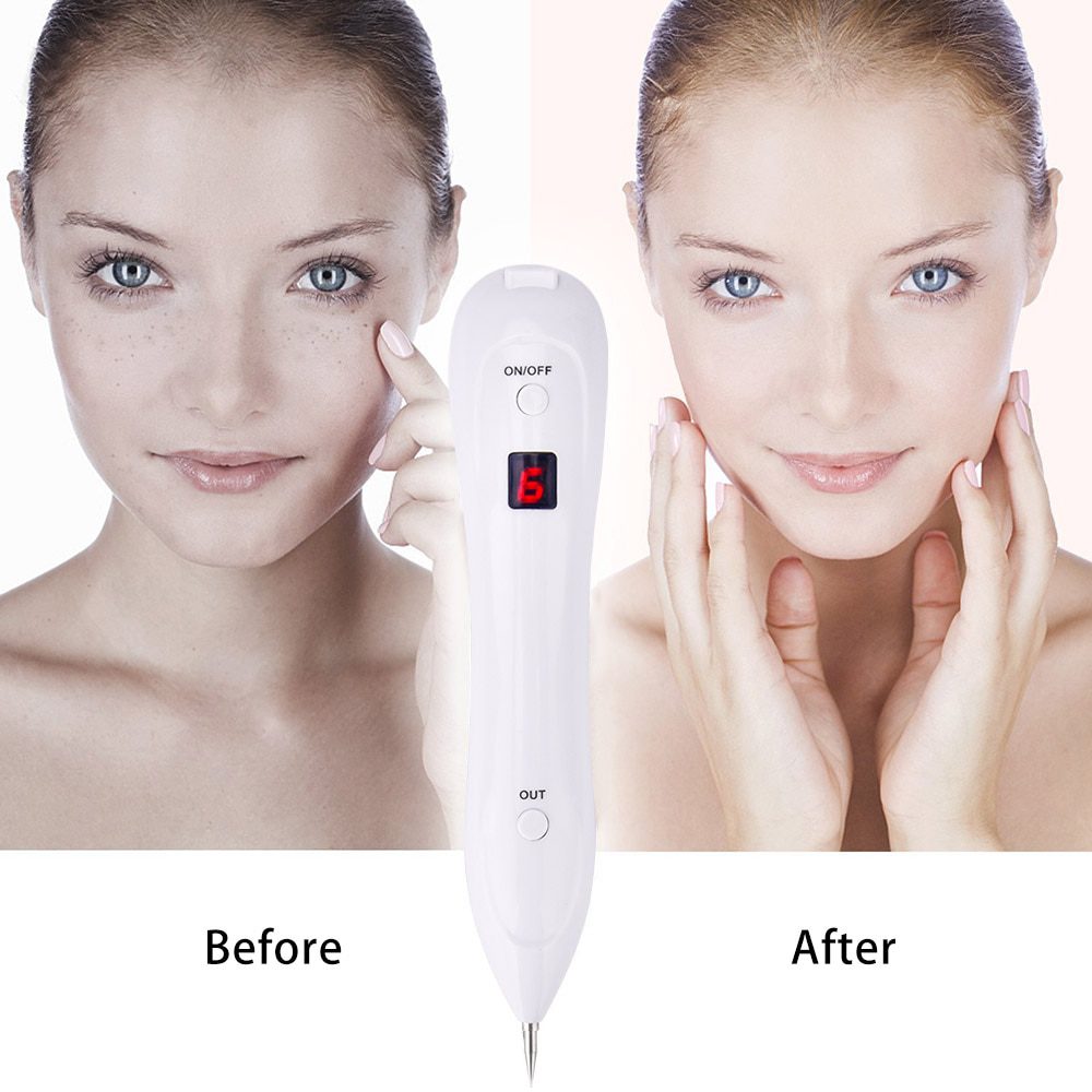 Skin Care Laser Mole Tattoo Freckle Removal Pen LCD Sweep Spot Mole Removing Wart Corns Dark Spot Remover Salon Beauty Machine