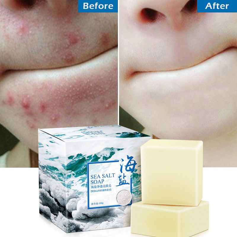 100g Removal Pimple Pore Acne Treatment Sea Salt Soap Cleaner Moisturizing Goat Milk Soap Face Care Wash Basis Soap TSLM1
