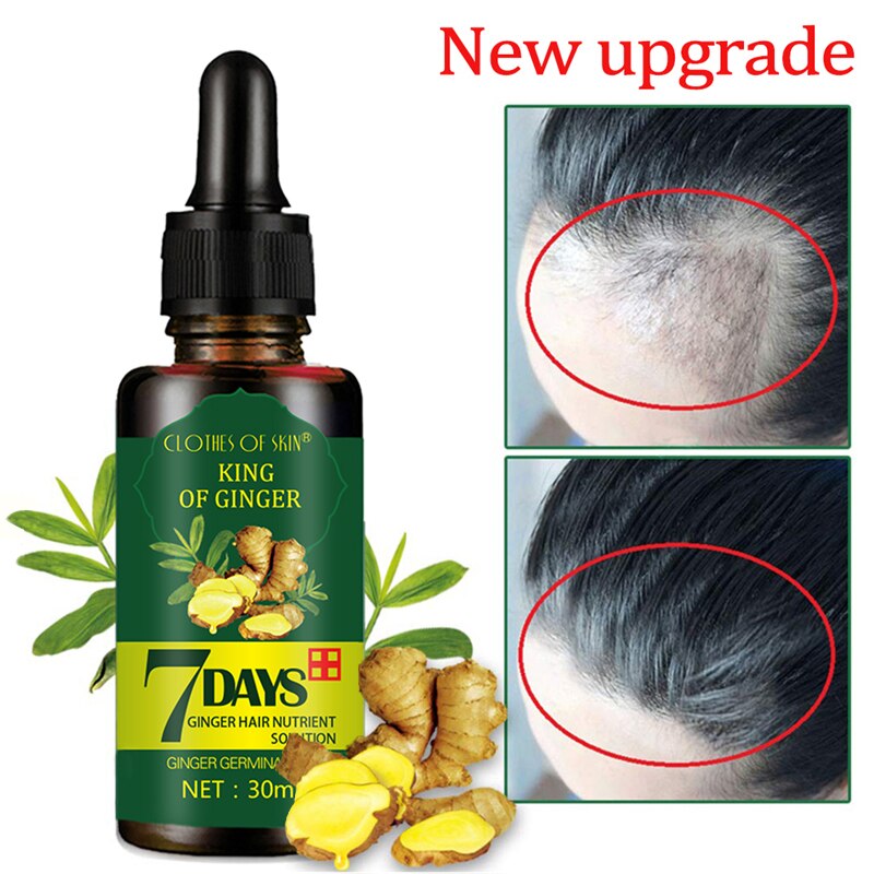 7 Days Ginger Hair Growth Essence Hairdressing Hair Product Oil Serum Dry and Damaged Treatment 30 ml Deeply Nutrition Care