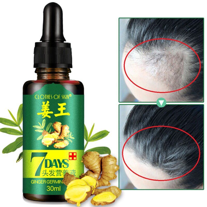 7 Days Ginger Hair Growth Essence Hairdressing Hair Product Oil Serum Dry and Damaged Treatment 30 ml Deeply Nutrition Care