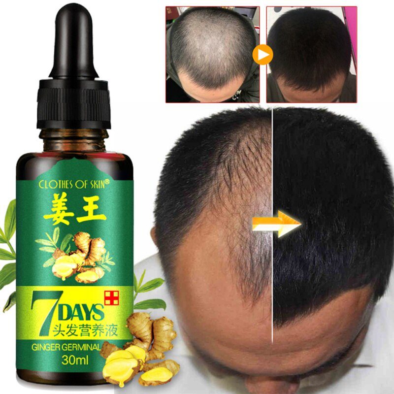 7 Days Ginger Hair Growth Essence Hairdressing Hair Product Oil Serum Dry and Damaged Treatment 30 ml Deeply Nutrition Care