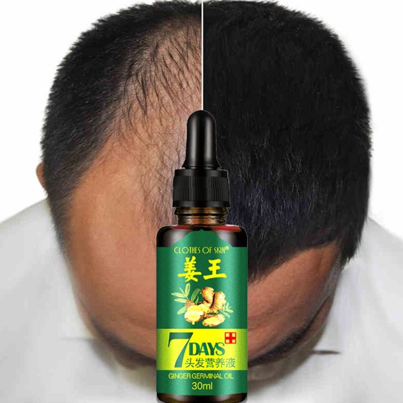 7 Days Ginger Hair Growth Essence Hairdressing Hair Product Oil Serum Dry and Damaged Treatment 30 ml Deeply Nutrition Care