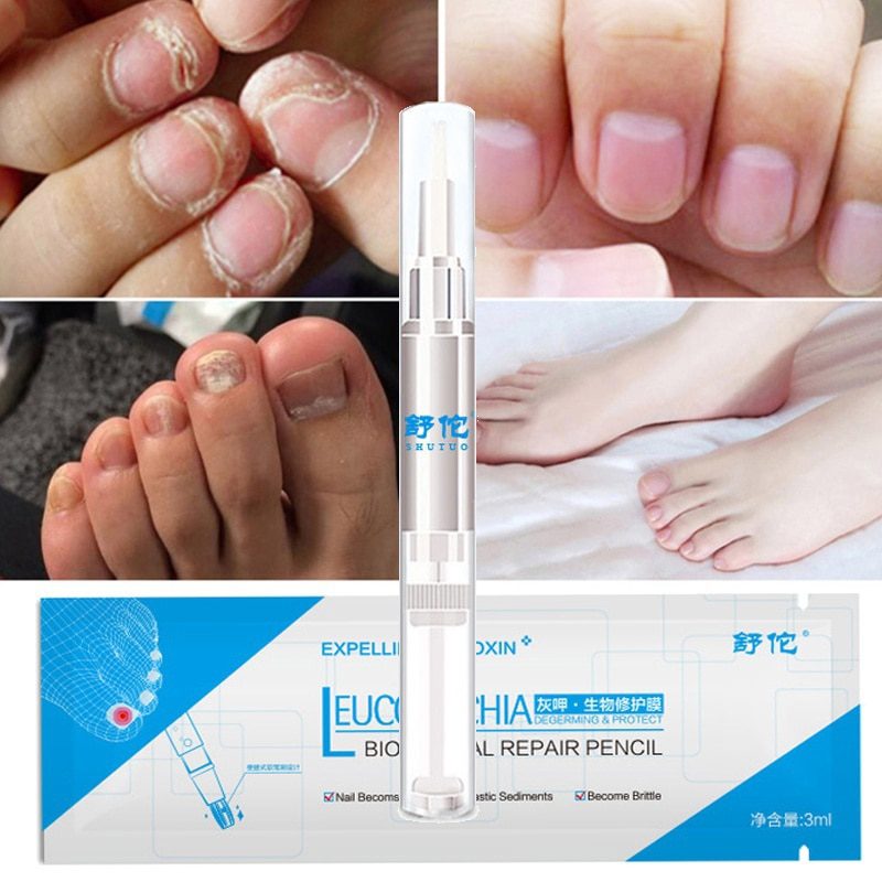 3ML Nail Fungus Treatment Nail Oil Pen Anti Fungal Nail Cuticle Remover Liquid Nail Growth Skin Care TSLM2