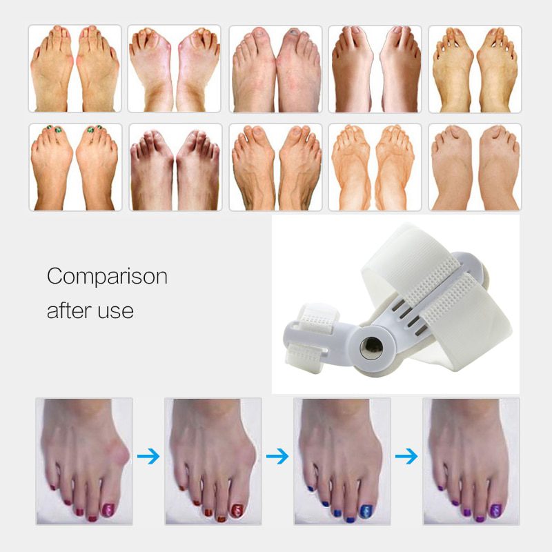 USA 2Pcs Toe Protector Feet Care Pedicure Tool Bunion Hallux Valgus Corrector Orthopedic Supplies Big Toe Splint Straightener