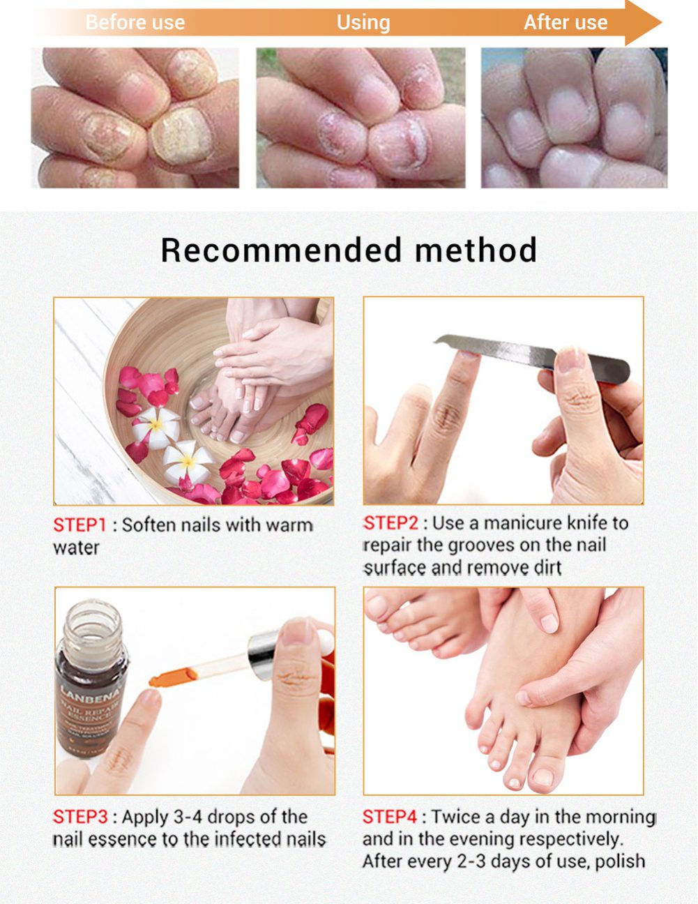 LANBENA Nail Repair Liquid Treatment with File Nail Anti Remove Nail Onychomycosis Fungus Toe Nourishing Brighten Nail TSLM1