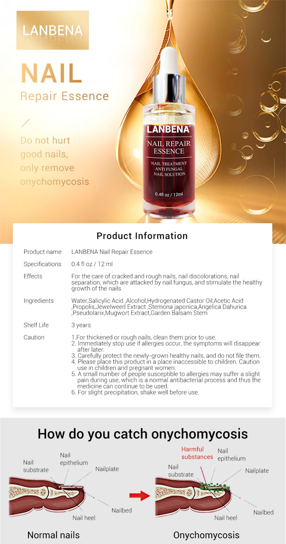 LANBENA Nail Repair Liquid Treatment with File Nail Anti Remove Nail Onychomycosis Fungus Toe Nourishing Brighten Nail TSLM1