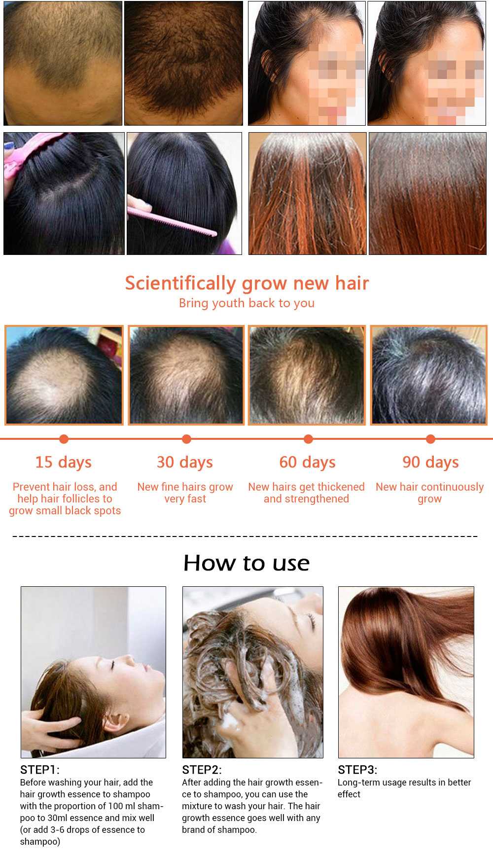AMEIZII Andrea 20ml Ginger Extract Dense Hair Fast Sunburst Hair Growth Essence Restoration Hair Loss Liquid Serum Hair Care Oil