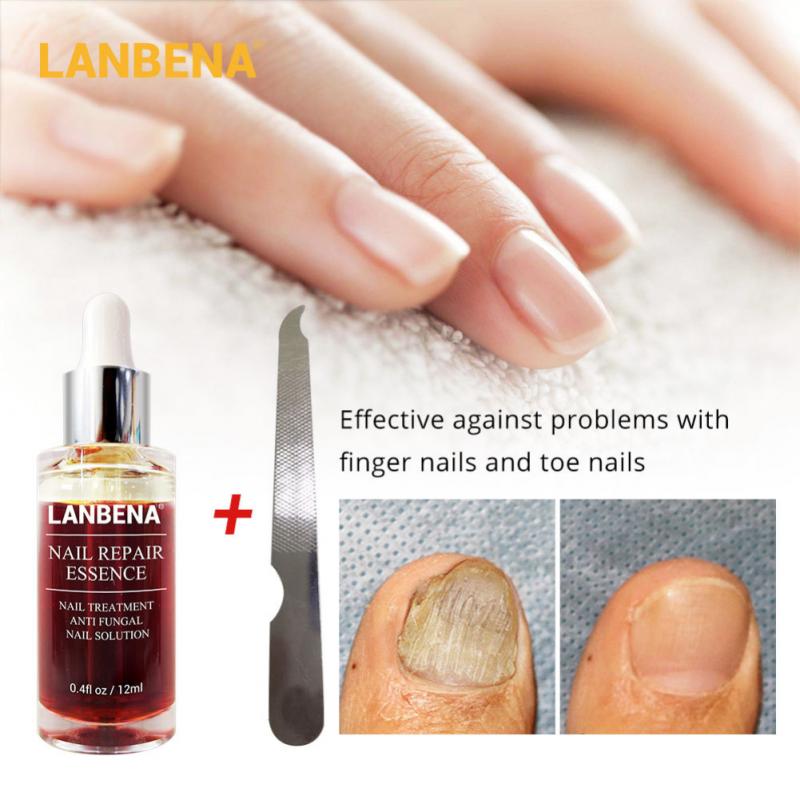 Upgraded Version LANBENA Nail Repair Liquid Treatment With File Nail Anti Remove Nail Onychomycosis Fungus Toe Nail Care TSLM1