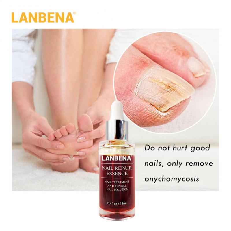 Upgraded Version LANBENA Nail Repair Liquid Treatment With File Nail Anti Remove Nail Onychomycosis Fungus Toe Nail Care TSLM1