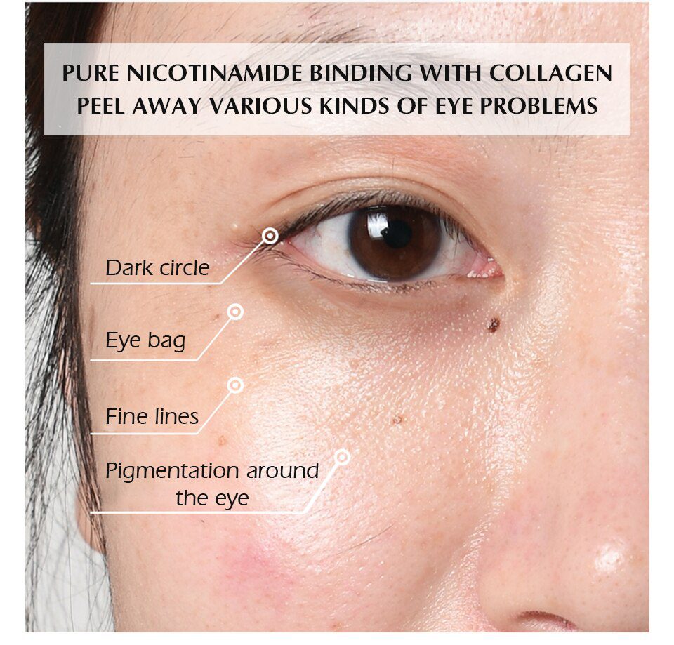 MEIKING Eye Patches 60 Pcs Hyaluronic Acid Nicotinamide Remover Dark Circles Anti-wrinkle Mask Under The Eyes Of Korea