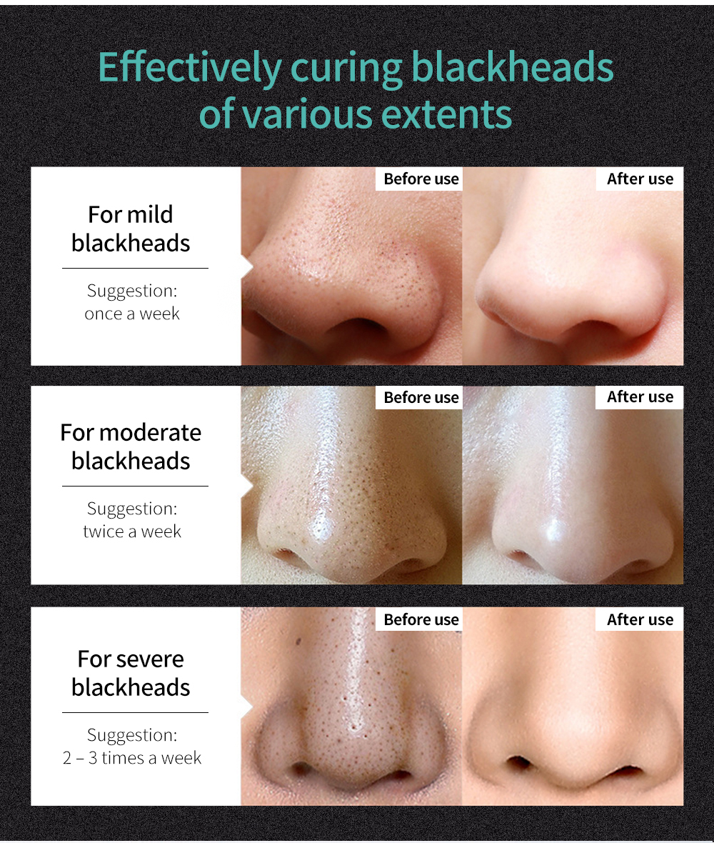 Korea Blackhead Remover Nose Black Mask Face Care Mud Acne Treatment Peel Off Mask Pore Strip Peel Mask Oil Control Skin Care