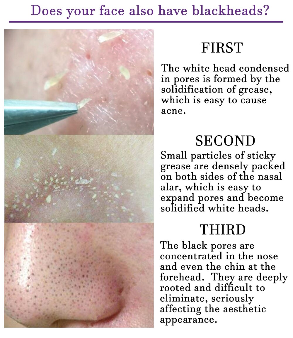 Blackhead Remover Nose Face Mask Pore Strip tearing Black Mask Peeling Acne Treatment Unisex Deep Cleansing Skin Care Korea
