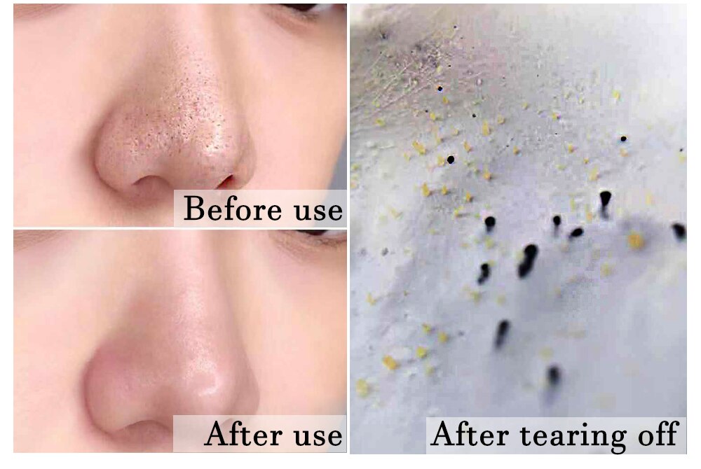 Blackhead Remover Nose Face Mask Pore Strip tearing Black Mask Peeling Acne Treatment Unisex Deep Cleansing Skin Care Korea