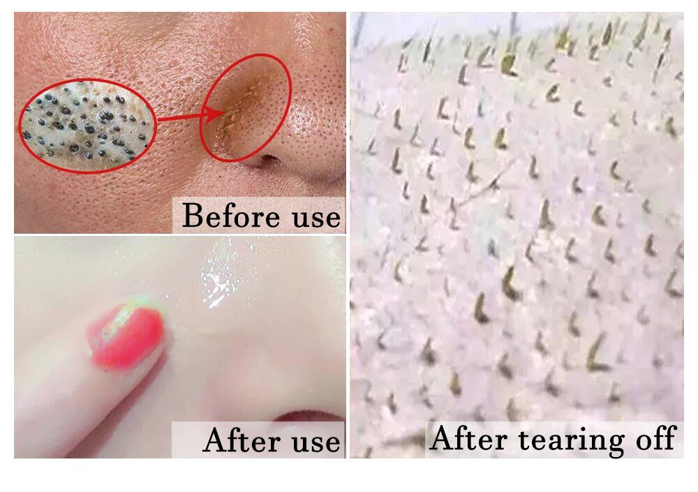 Blackhead Remover Nose Face Mask Pore Strip tearing Black Mask Peeling Acne Treatment Unisex Deep Cleansing Skin Care Korea