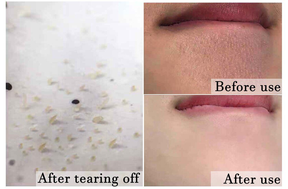 Blackhead Remover Nose Face Mask Pore Strip tearing Black Mask Peeling Acne Treatment Unisex Deep Cleansing Skin Care Korea