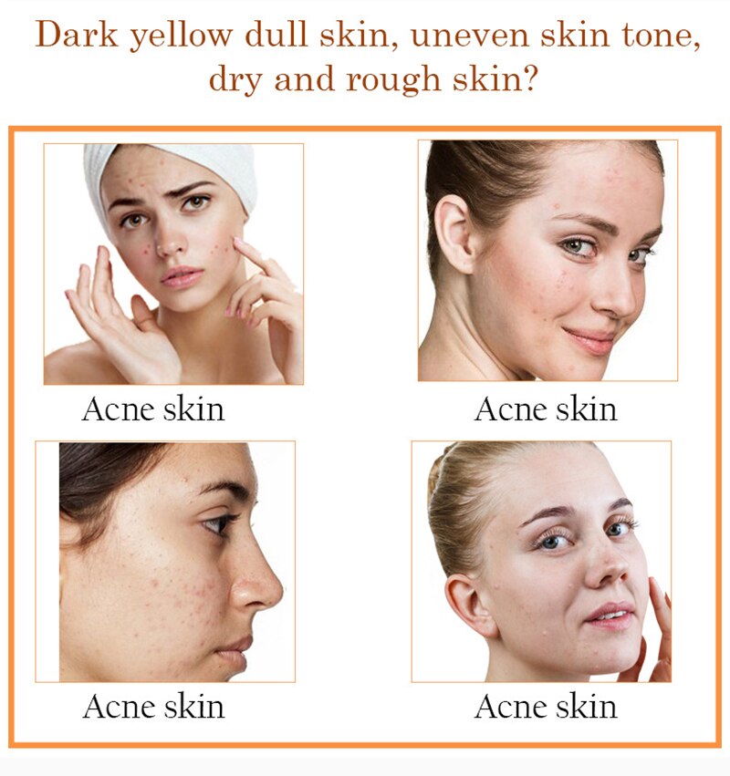 30ml Vitamin C Face Serum Long Lasting Moisturizing Improve Roughness Lighten Spots Hyaluronic Acid Facial Essence
