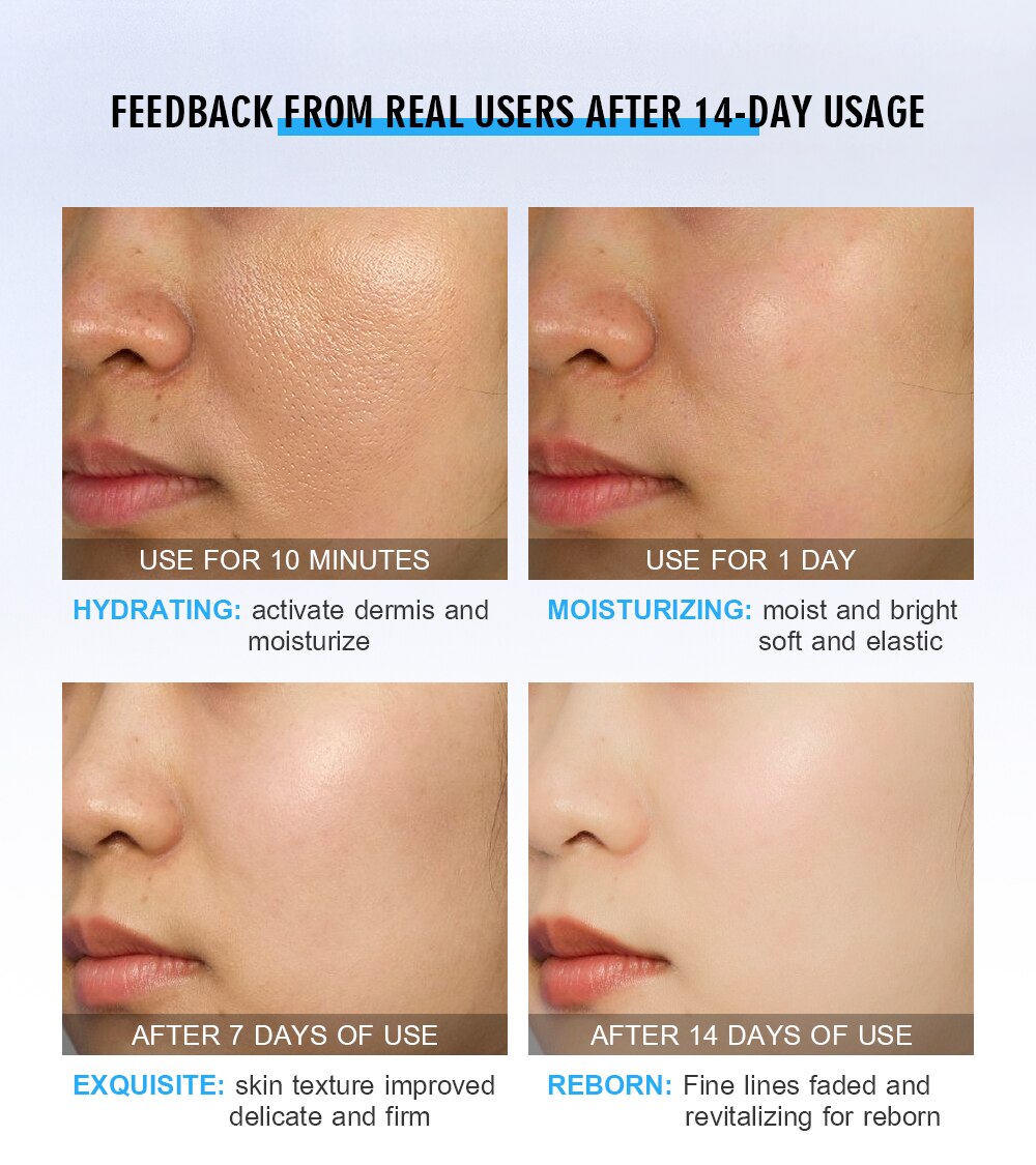 VENZEN Hyaluronic Acid Moisturizing Face Serum Shrink Pores Remove Fine Lines Anti-Aging Anti-Wrinkle Plant Cream Skin Care 15ML
