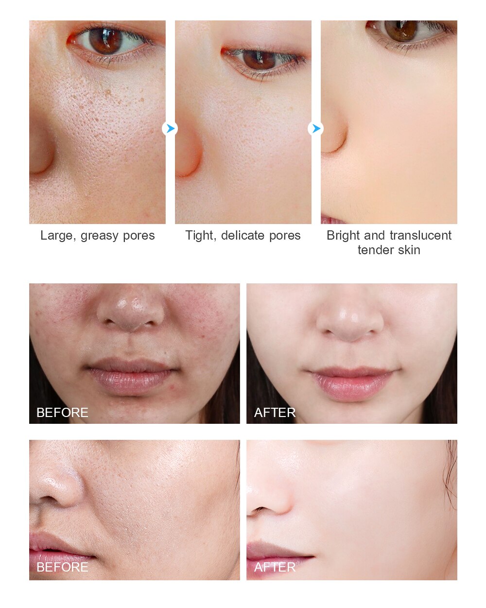 VENZEN Hyaluronic Acid Moisturizing Face Serum Shrink Pores Remove Fine Lines Anti-Aging Anti-Wrinkle Plant Cream Skin Care 15ML