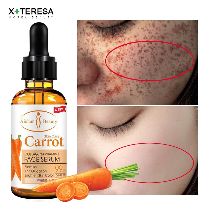 Dark Spot Corrector Whitening Serum Face Bleaching Serum Brighten Blemish Freckle Remover Natural Carrot Essence Korea Skin Care