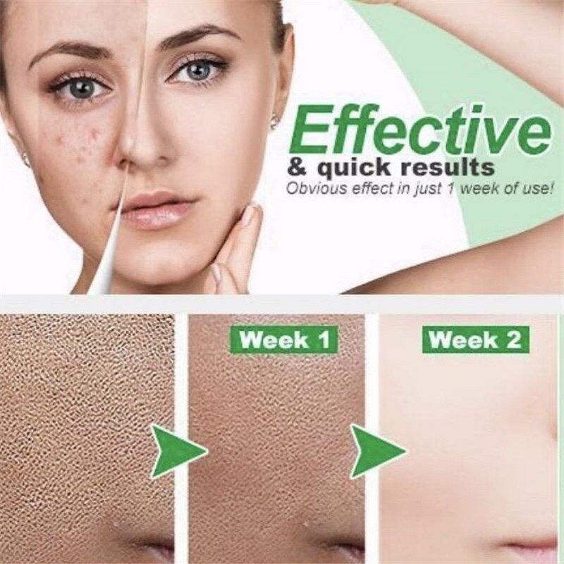 Belay ZeroPore Instant Perfection Serum Lactobionic Acid Face Solution Serum Minimize Pores Oil-Control Whitening Anti-Wrinkle