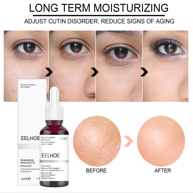 Salicylic Acid Shrink Pores Serum Fruit Acid Exfoliating Moisturizing Nourish Smooth Pores Repair Essence Products Skin Care