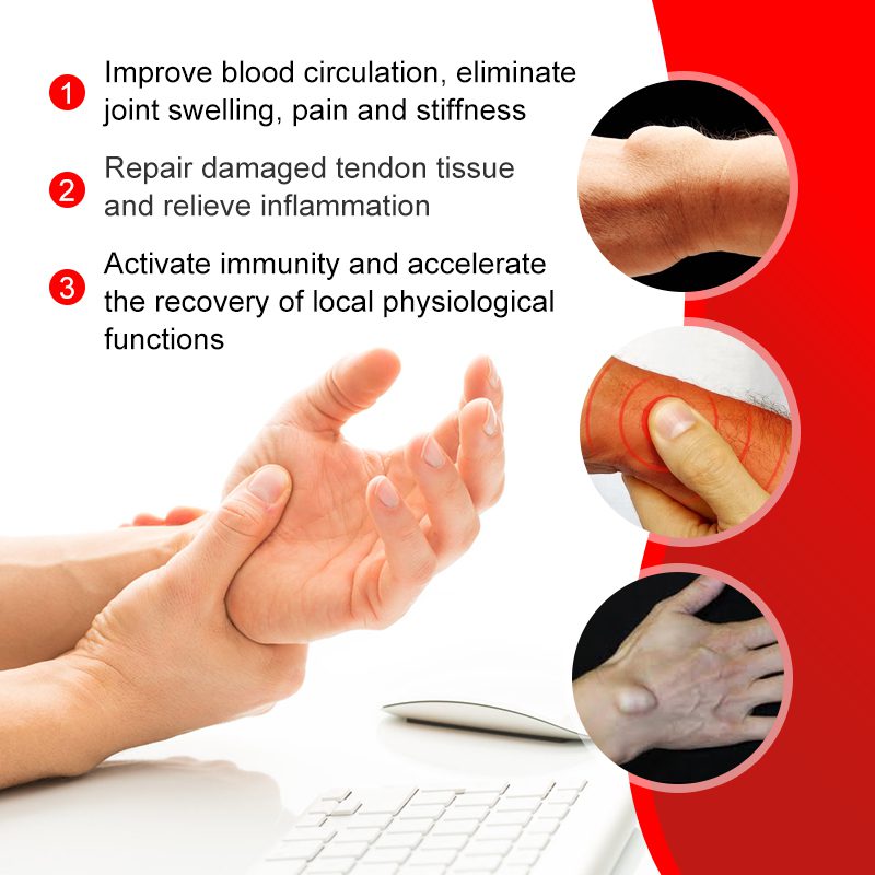 1Pcs 20g Arthritis Treatment Pain Relief Ointment Tenosynovitis Care Sports Support Cream Therapy Chinese medicine Plaster Hand