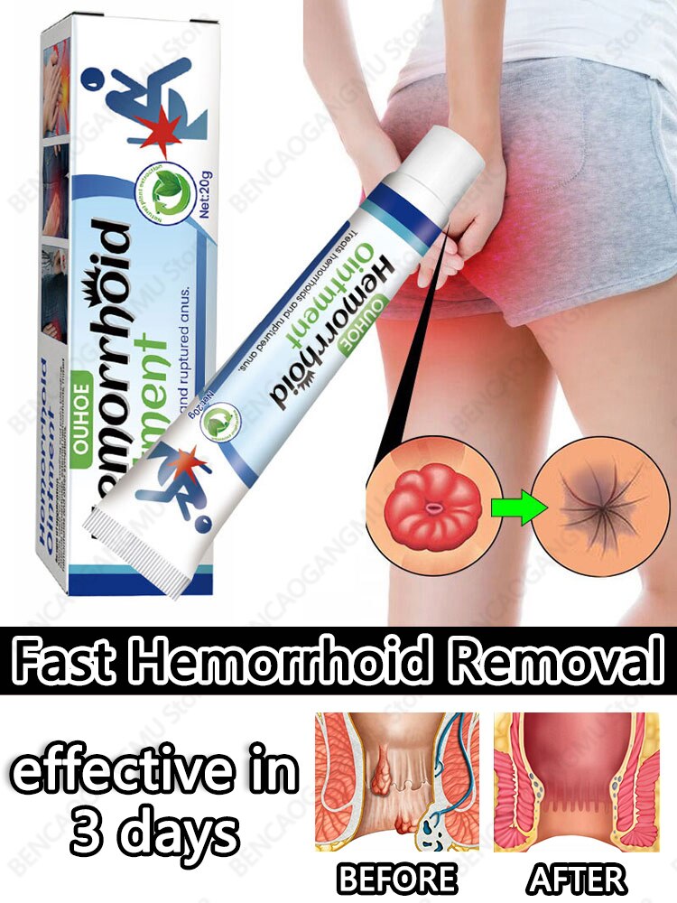 Hemorrhoids Treatment Cream Remove Internal External Hemorrhoids Internal Piles Removal Ointment Gel Products For Hemorrhoids