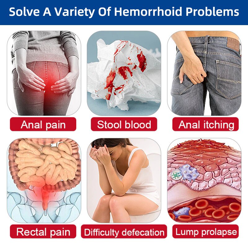 Hemorrhoids Treatment Cream Remove Internal External Hemorrhoids Internal Piles Removal Ointment Gel Products For Hemorrhoids