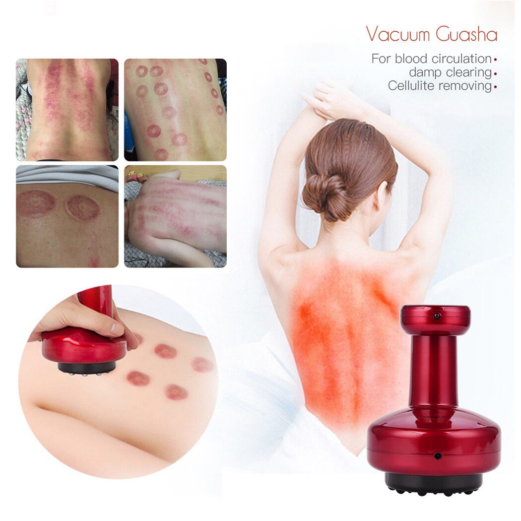 CkeyIN Body Shaping Massager Electric Heat Cupping Gua Sha Scrapping Massage Negative Pressure Back Detoxification Rechargeable