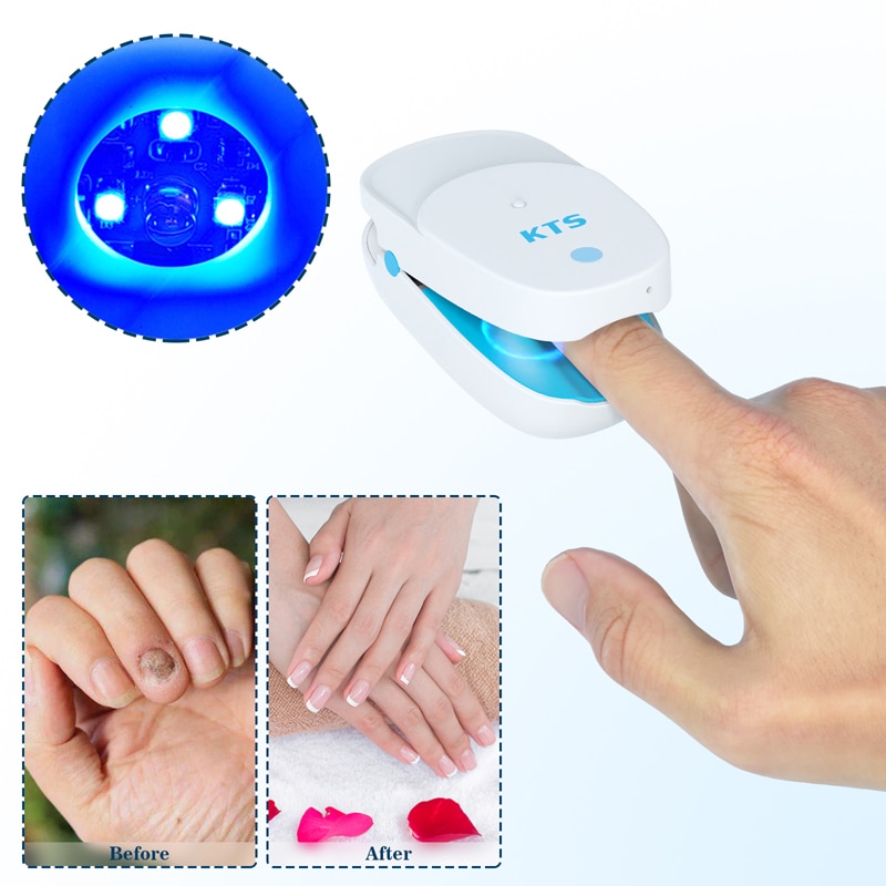Fungal Nail Treatment Laser Device For Nail Fungus 905nm 470nm Fungus Nail Removal Anti Infection Paronychia Onychomycosis Care