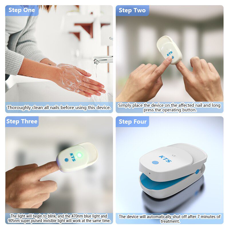 Fungal Nail Treatment Laser Device For Nail Fungus 905nm 470nm Fungus Nail Removal Anti Infection Paronychia Onychomycosis Care