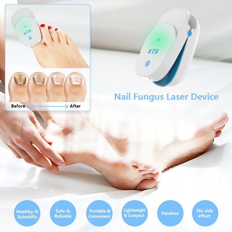 Fungal Nail Treatment Laser Device For Nail Fungus 905nm 470nm Fungus Nail Removal Anti Infection Paronychia Onychomycosis Care